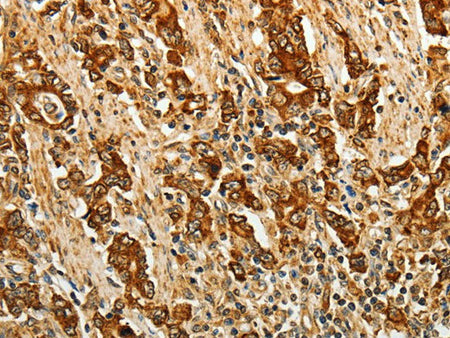 AKR1B1 Polyclonal Antibody Store at -20°C