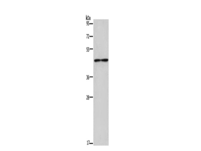 IL5RA Polyclonal Antibody Store at -20°C