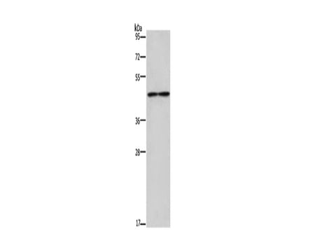IL5RA Polyclonal Antibody Store at -20°C