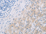 PFN2 Polyclonal Antibody