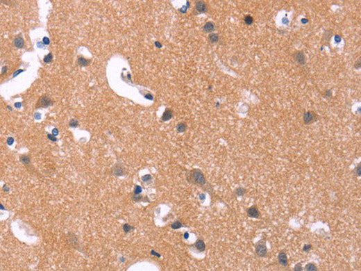 MAPK11 Polyclonal Antibody Store at -20°C