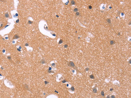 MAPK11 Polyclonal Antibody Store at -20°C