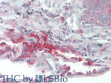 SLC34A2 Polyclonal Antibody Store at -20°C
