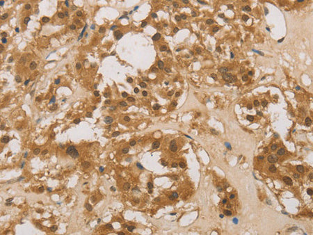 DACH1 Polyclonal Antibody Store at -20°C
