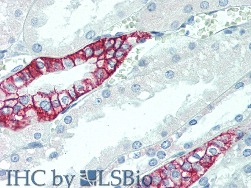 SCN10A Polyclonal Antibody