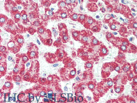 HSD17B8 Polyclonal Antibody Store at -20°C