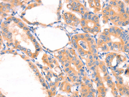 PRDX2 Polyclonal Antibody Store at -20°C