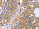 NRTN Polyclonal Antibody