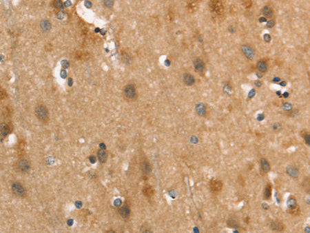 CALCRL Polyclonal Antibody Store at -20°C