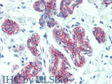 DSG2 Polyclonal Antibody Store at -20°C