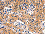 AMY2A Polyclonal Antibody Store at -20°C