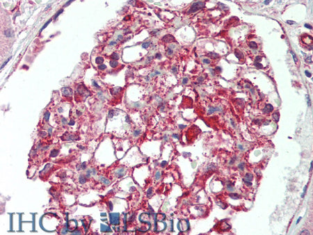 IL17RB Polyclonal Antibody Store at -20°C