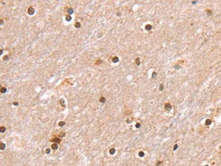 SMARCB1 Polyclonal Antibody Store at -20°C