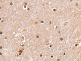 SMARCB1 Polyclonal Antibody Store at -20°C