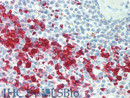 CCL17 Polyclonal Antibody