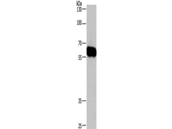 CORO1C Polyclonal Antibody Store at -20°C