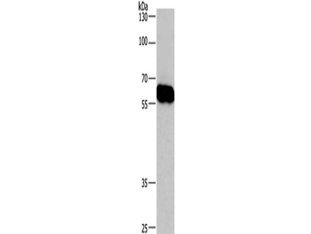 CORO1C Polyclonal Antibody Store at -20°C