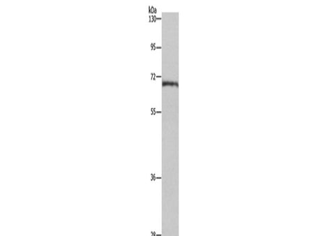 HSF27 Polyclonal Antibody Store at -20°C