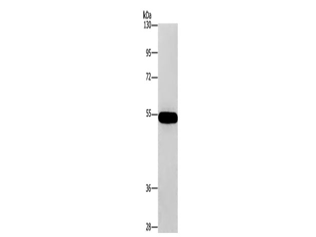 CNDP1 Polyclonal Antibody Store at -20°C