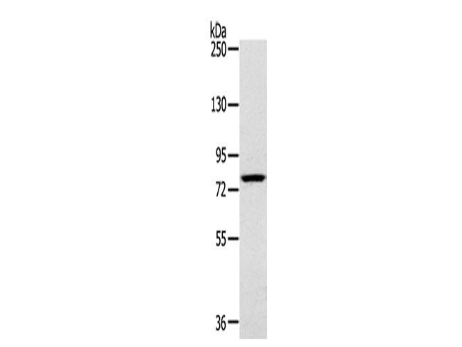 RPS6KA1 Polyclonal Antibody Store at -20°C