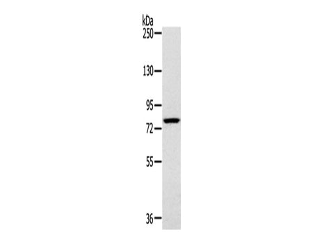 RPS6KA1 Polyclonal Antibody Store at -20°C
