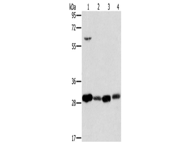 MRPL28 Polyclonal Antibody Store at -20°C