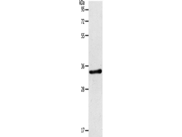ACY3 Polyclonal Antibody Store at -20°C