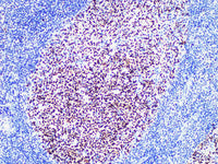 BCL6 Monoclonal Antibody