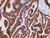 Beta-catenin Monoclonal Antibody Stored at -20°C
