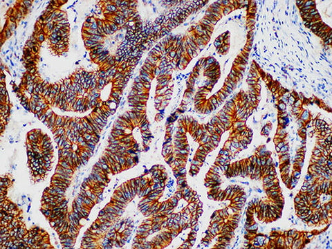 Beta-catenin Monoclonal Antibody Stored at -20°C