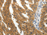 BIRC6 Polyclonal Antibody Host Rabbit