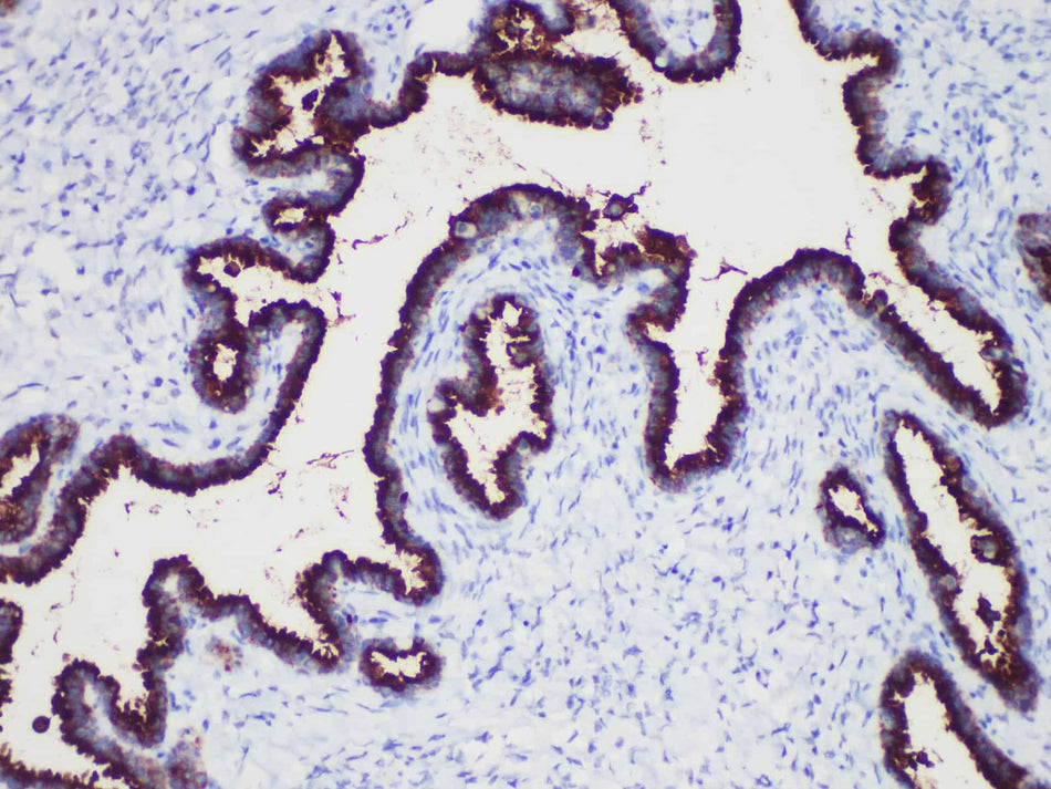 CA-125 Monoclonal Antibody