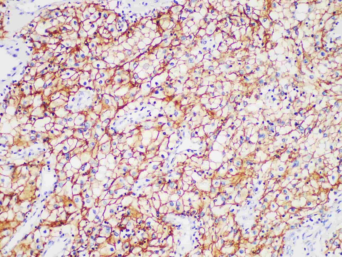 CA IX Monoclonal Antibody