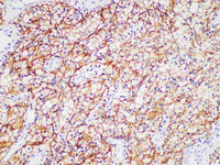 CA IX Monoclonal Antibody