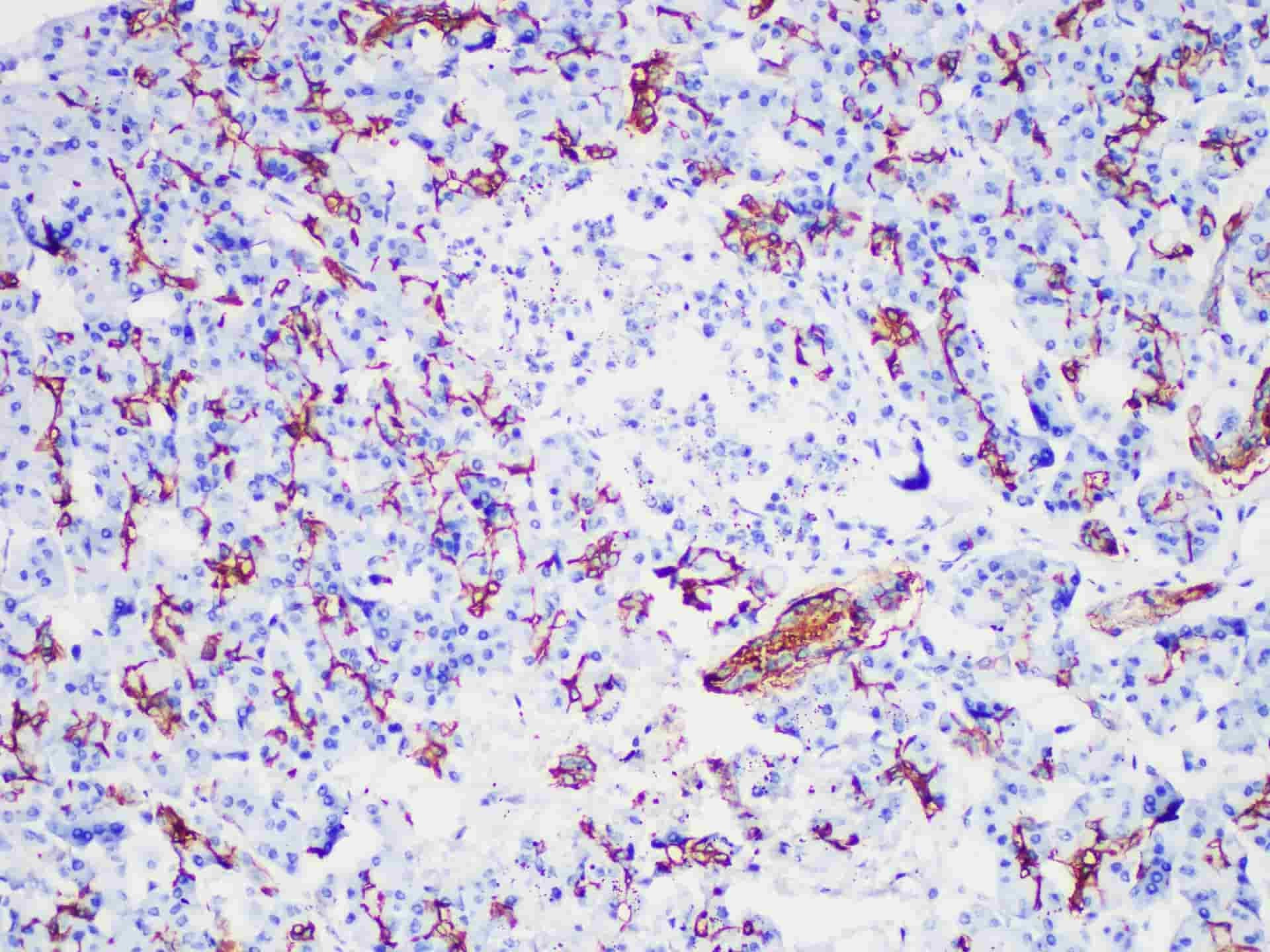 CA19-9 Monoclonal Antibody