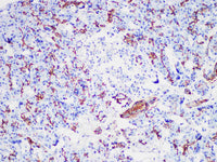 CA19-9 Monoclonal Antibody