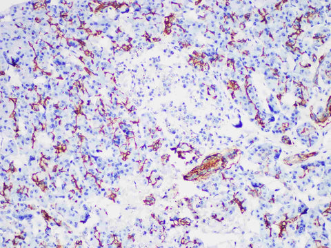 CA19-9 Monoclonal Antibody