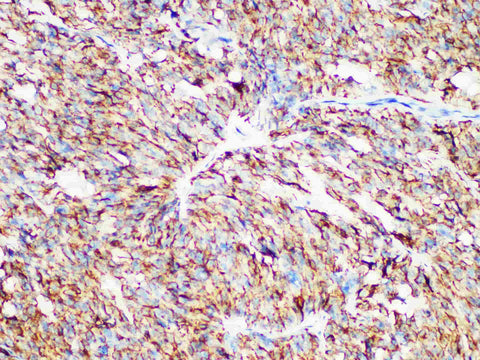 Calcitonin Monoclonal Antibody