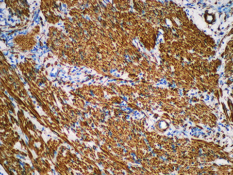Caldesmon Monoclonal Antibody Stored at -20°C