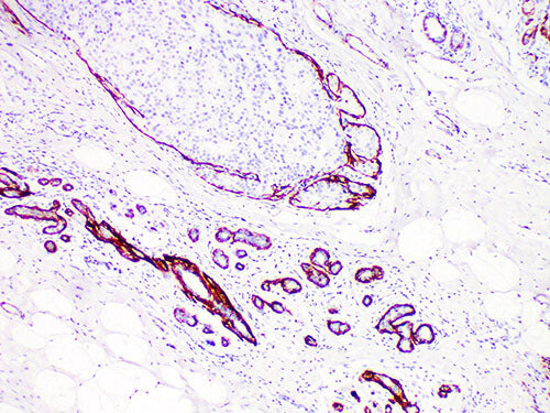 Calponin Monoclonal Antibody Stored at -20°C