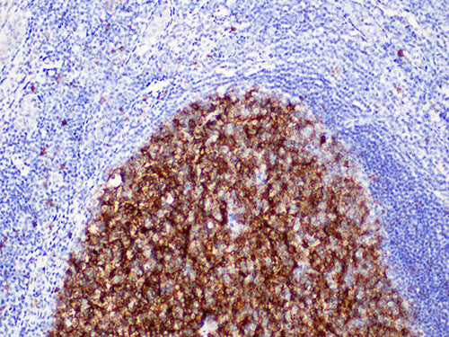 CD10 Monoclonal Antibody Stored at -20°C