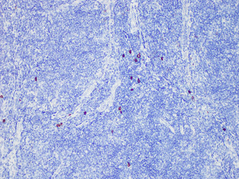 CD117/c-Kit Monoclonal Antibody Stored at -20°C