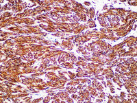 CD117/c-Kit Monoclonal Antibody Stored at -20°C Host Rabbit
