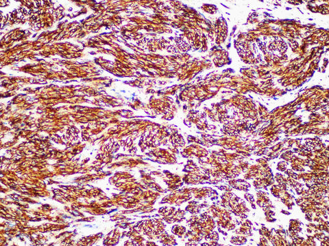 CD117/c-Kit Monoclonal Antibody Stored at -20°C Host Rabbit