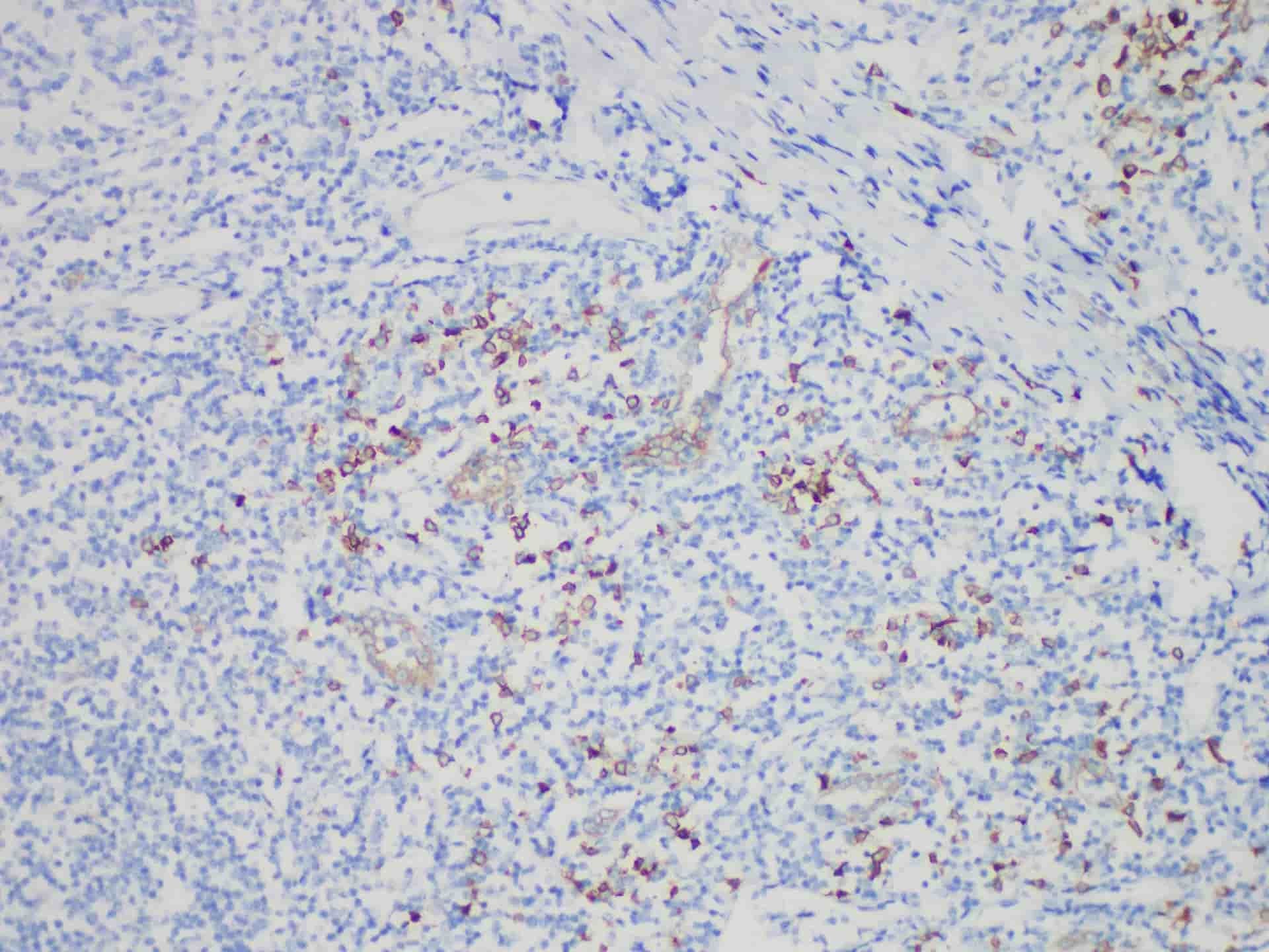CD123 Monoclonal Antibody Stored at -20°C