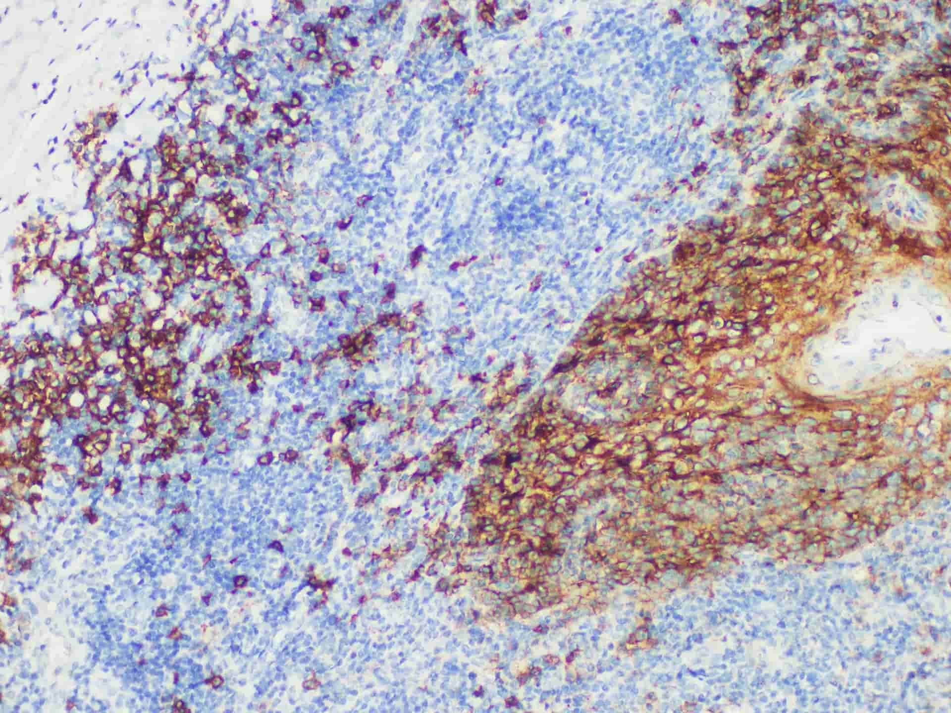CD138 Monoclonal Antibody Stored at -20°C