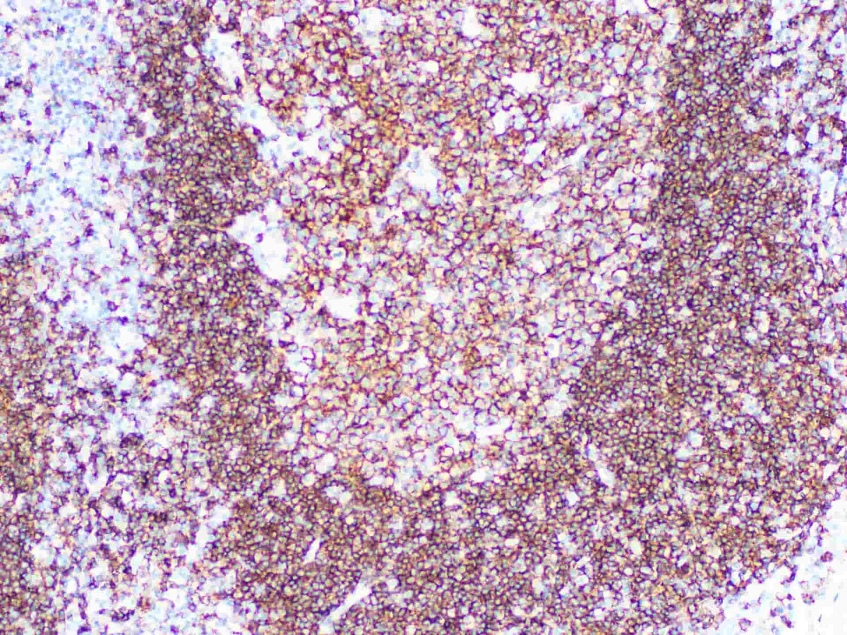 CD19 Monoclonal Antibody Stored at -20°C