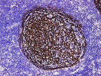 CD21 Monoclonal Antibody Stored at -20°C