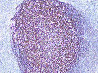 CD21 Monoclonal Antibody Stored at -20°C Host Rabbit