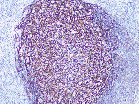 CD21 Monoclonal Antibody Stored at -20°C Host Rabbit
